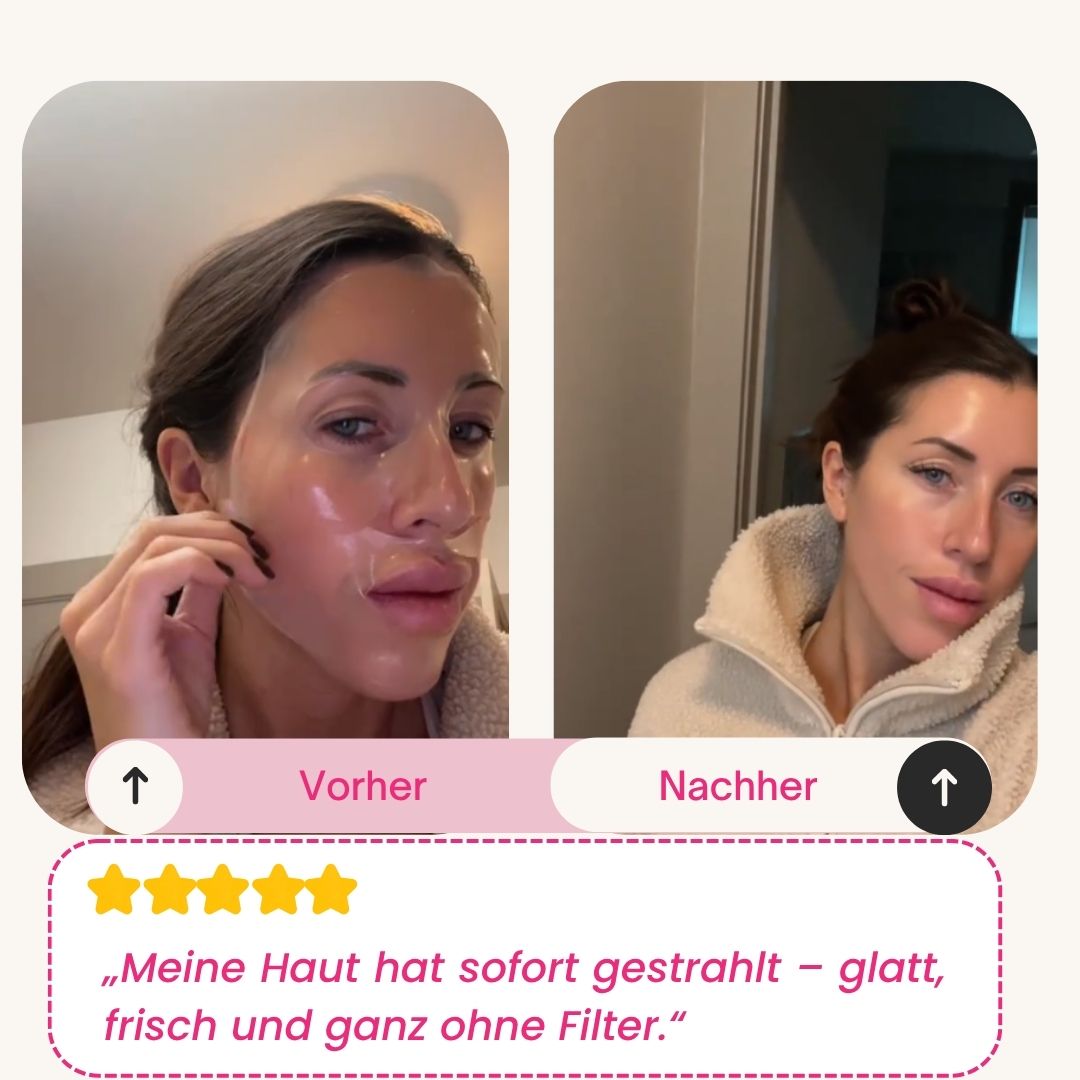 Skinly Bio-Collagen Mask (5 Masks)