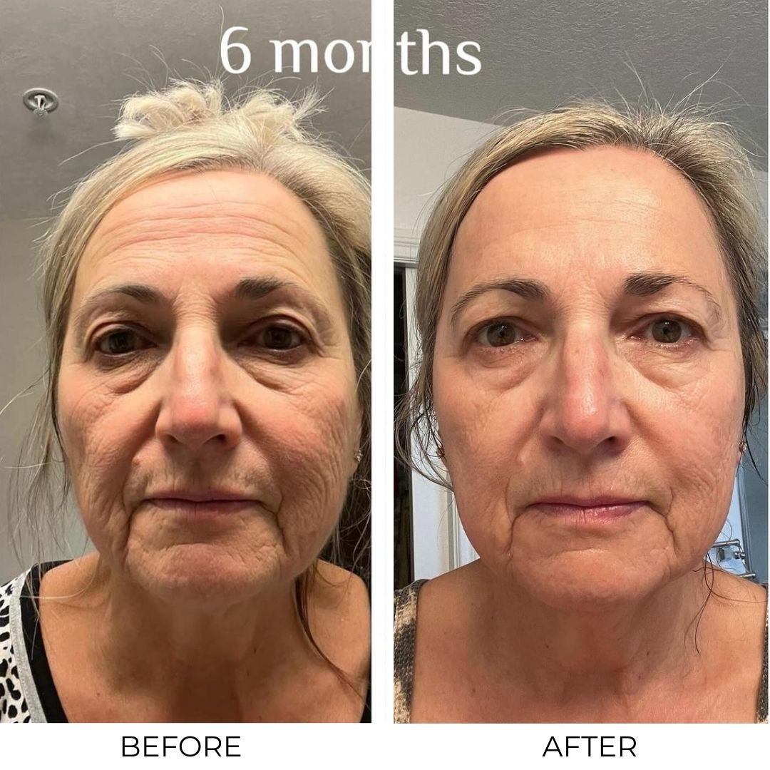Lifting Peptide Serum