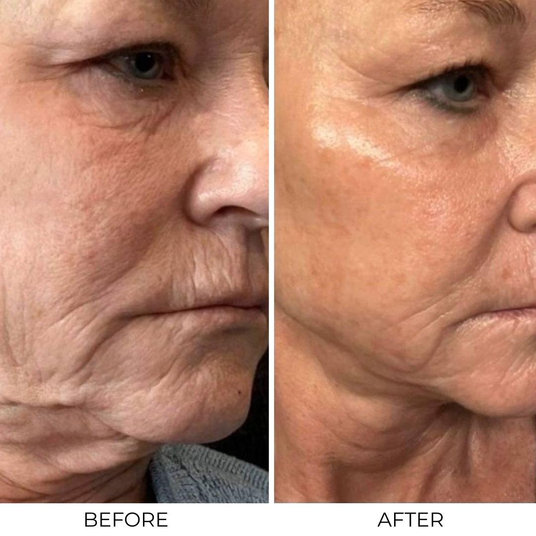 Lifting Peptide Serum