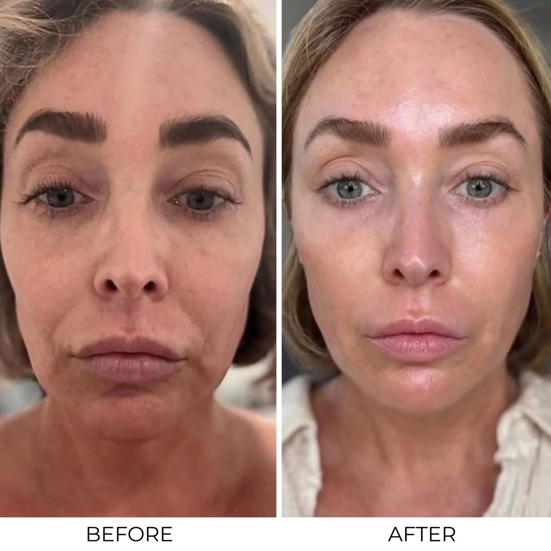 Lifting Peptide Serum