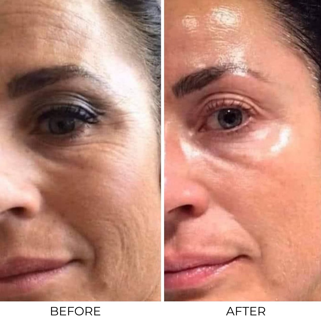 Lifting Peptide Serum
