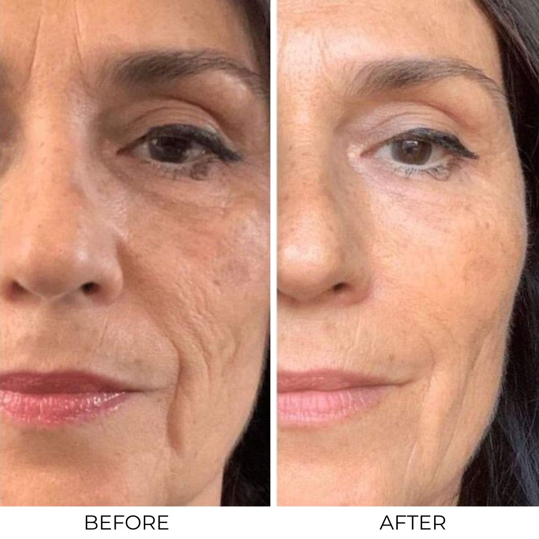 Otox Balm