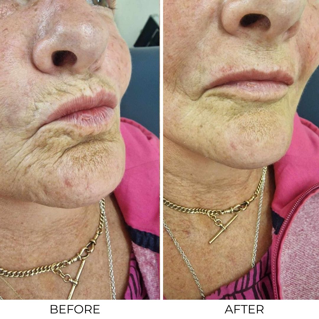 Otox Balm