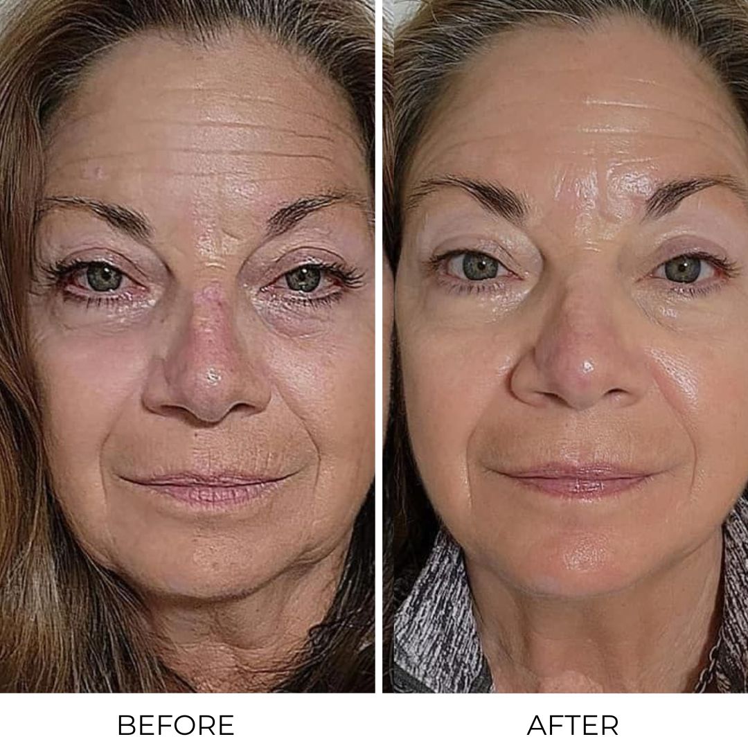 Otox Balm