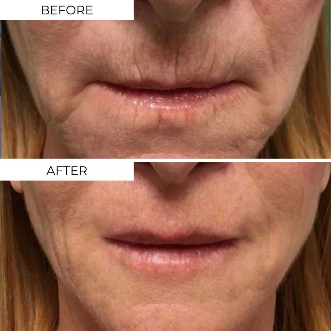 Otox Balm