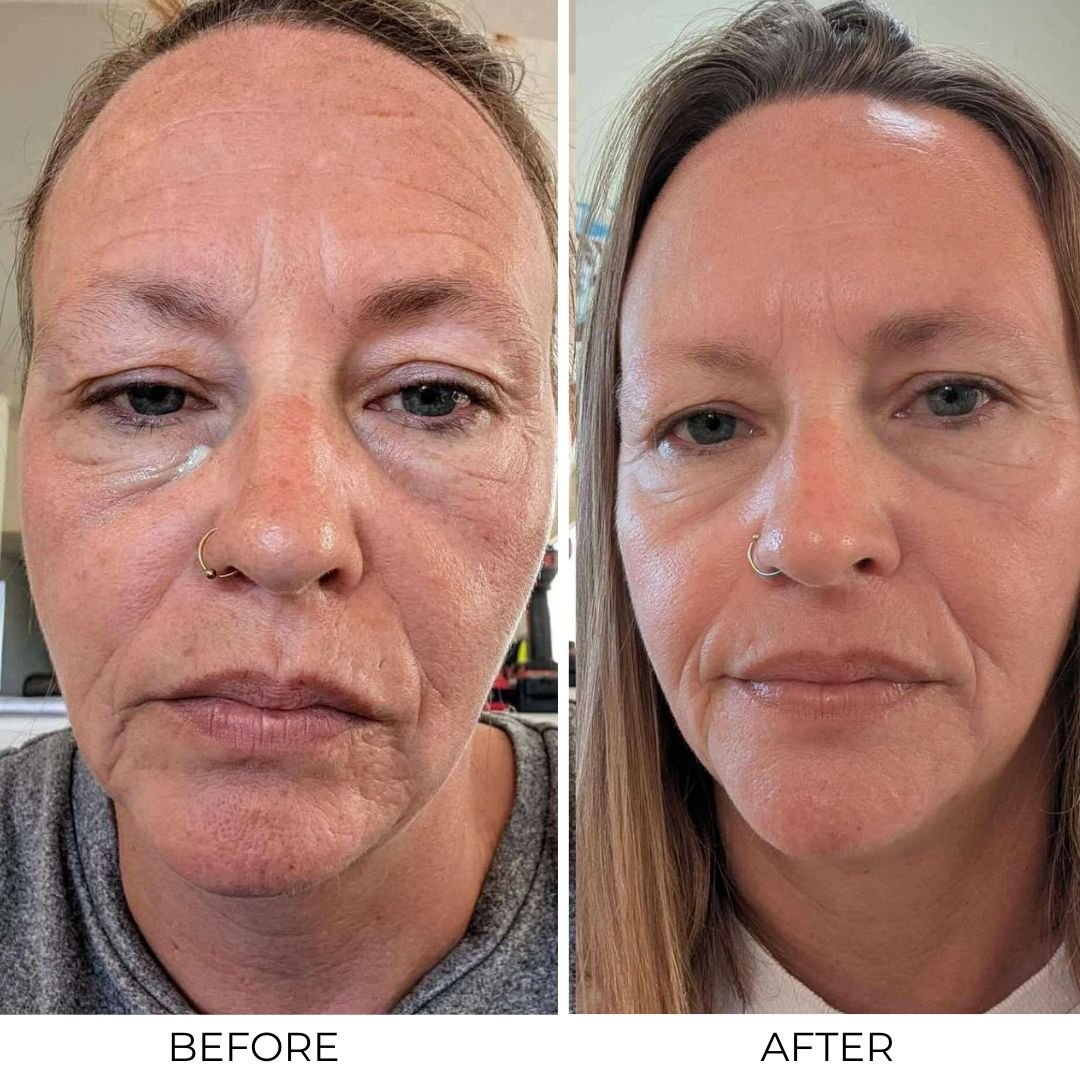 Otox Balm