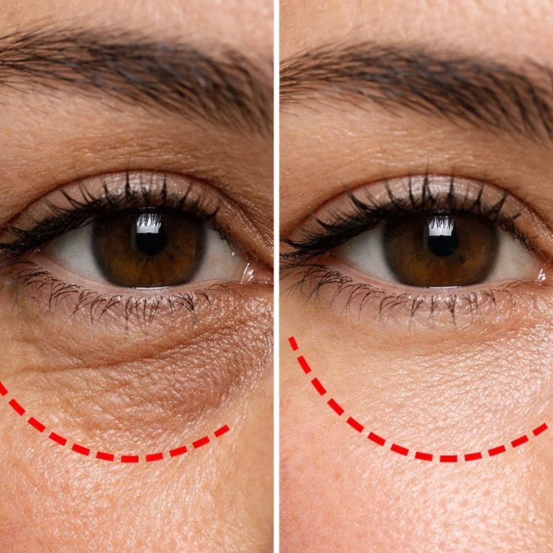 Delora Under Eye Foundation