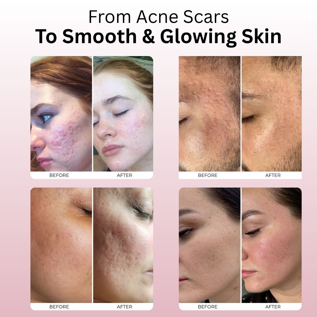 Glow Skin Renewal System