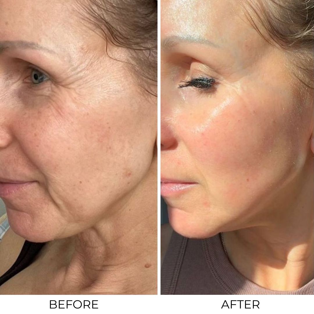 Lifting Peptide Serum